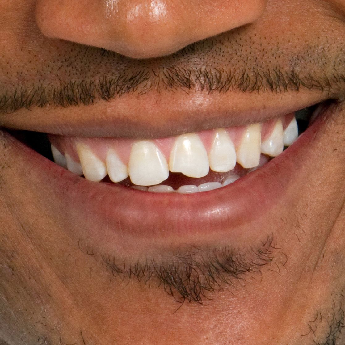 Closeup of man's smile