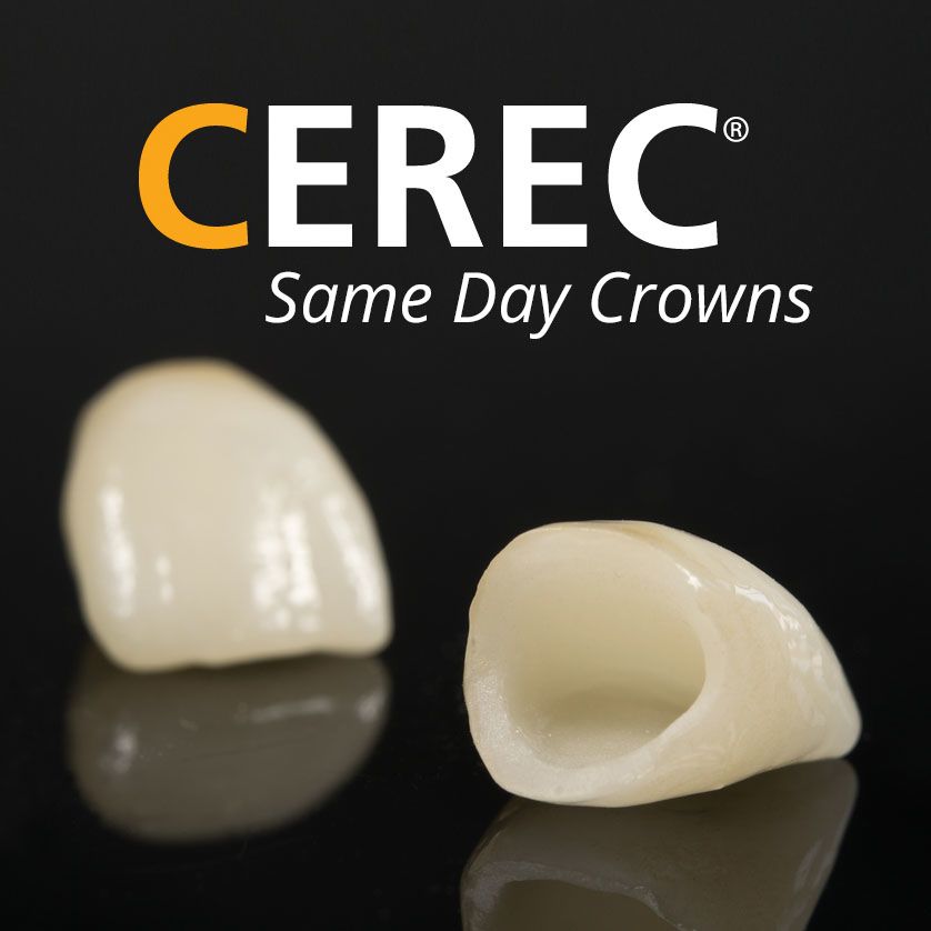 Dental Crowns