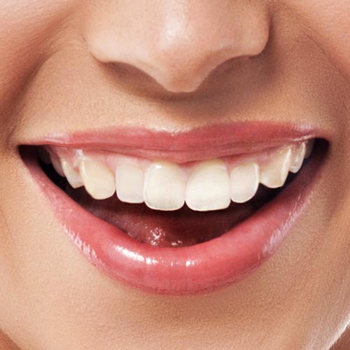 Closeup of woman's smile