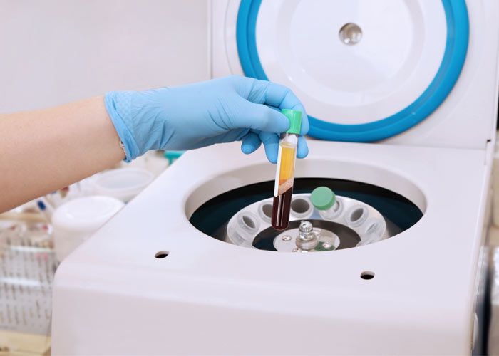 PRP centrifuge
