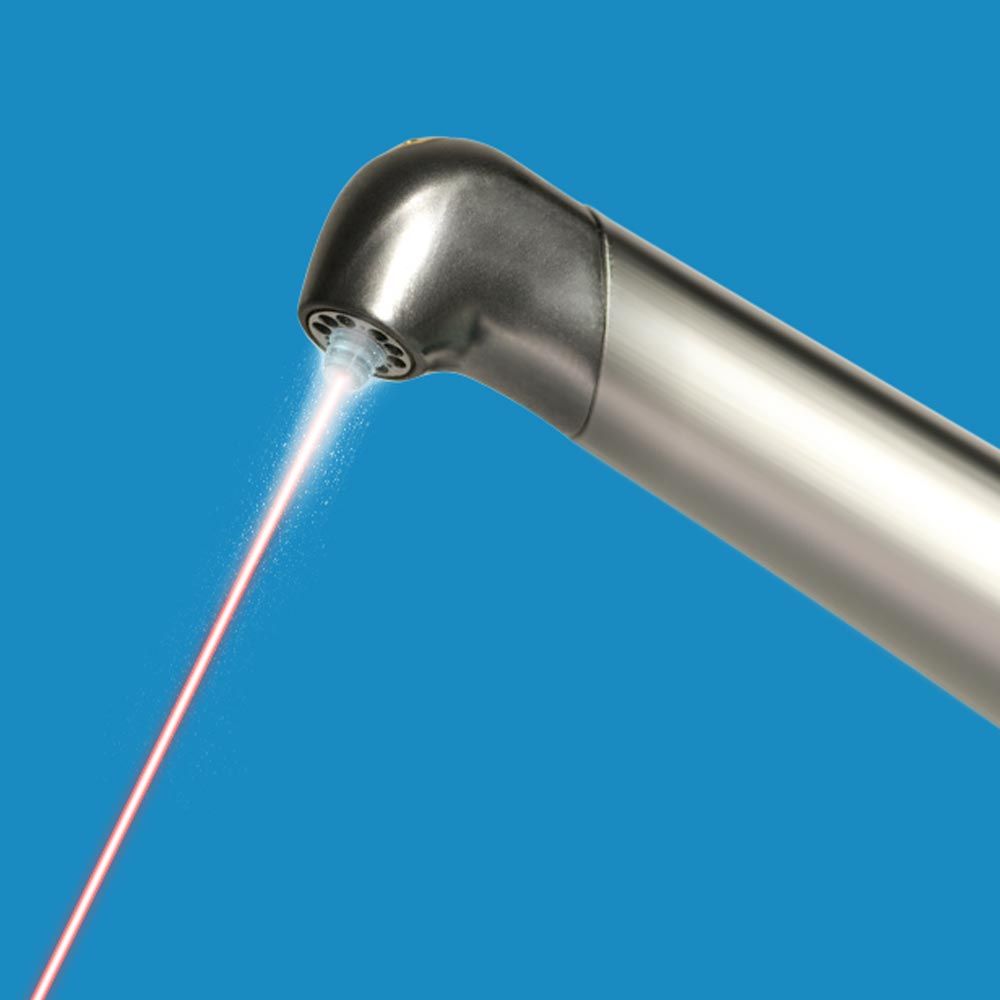 Illustration of dental laser
